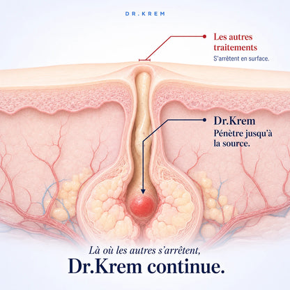 DR.KREM — Solution Acné Ciblée